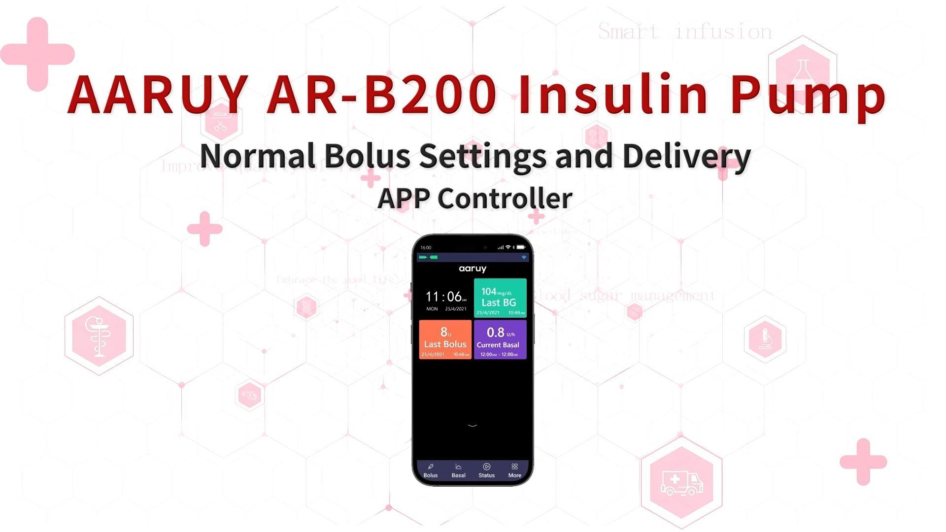 4. Normal Bolus Settings and Delivery__APP Controller