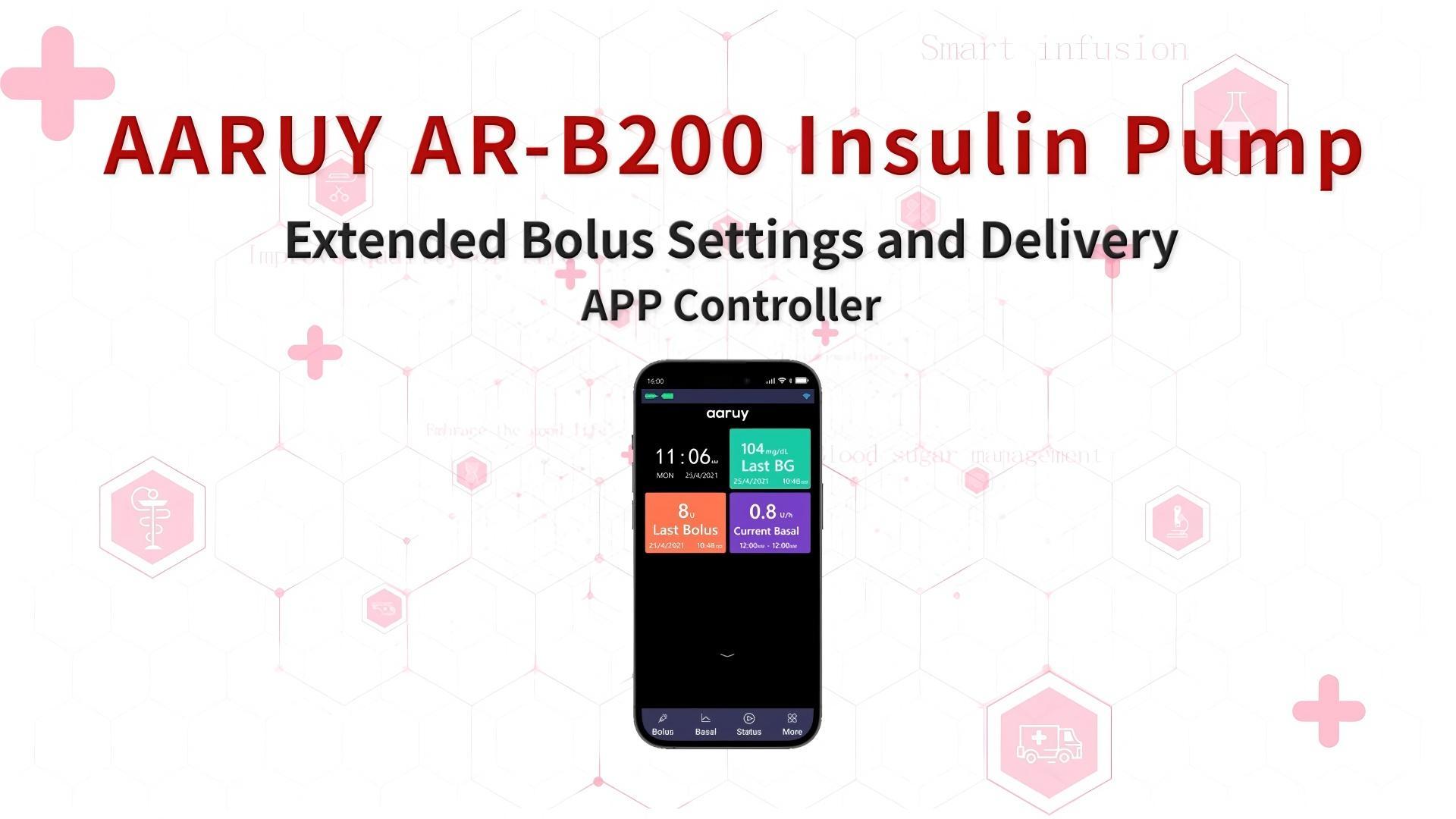 11. Extended Bolus Settings and Delivery__APP Controller 11. Extended Bolus Settings and Delivery__APP Controller