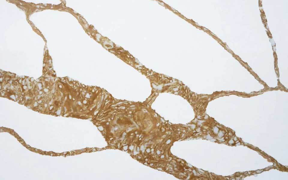 Calacatta Quartz Slab 1265
