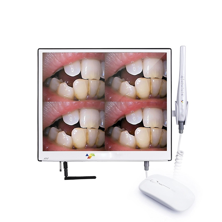Digital Intraoral Camera With Screen
