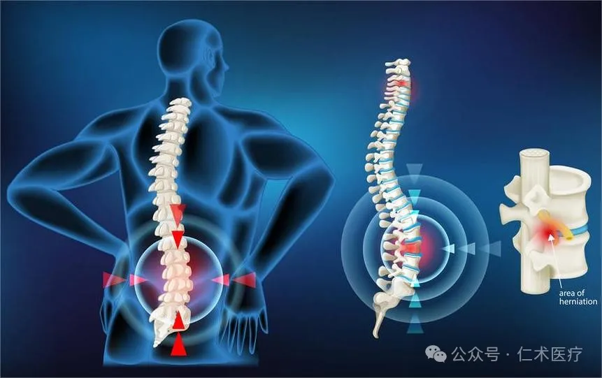 Spinal cord injury water treatment rehabilitation