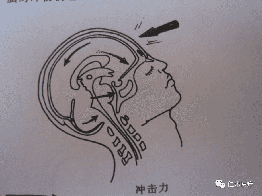 // Clinical Practical Water Therapy // Water Therapy Rehabilitation for Craniocerebral Injury
