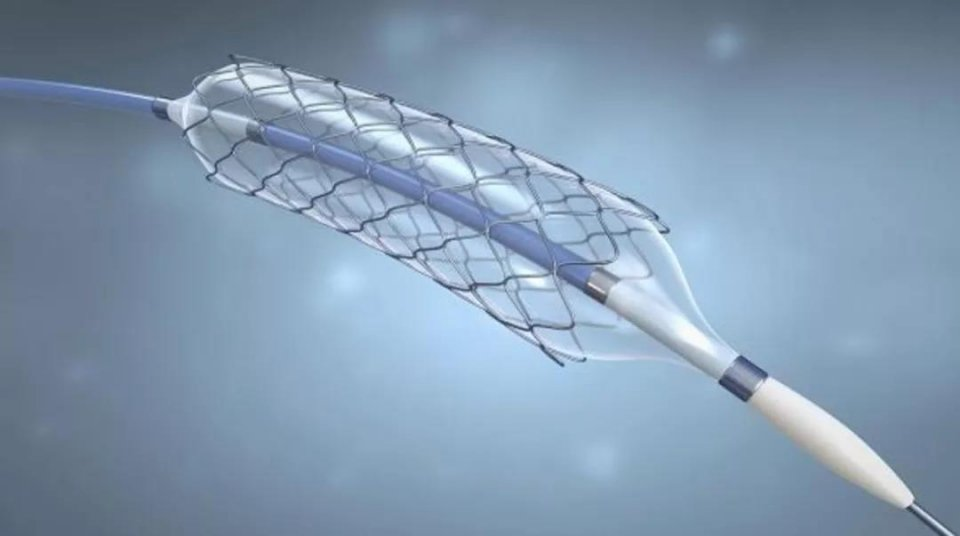 Application of Super-Elastic Alloys to Medical Stents that Self-Expand in Blood Vessels