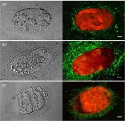 Antagonistic activity of Bacillus Firmus