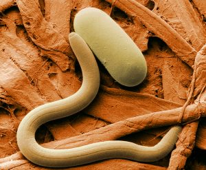 Scanning electron microscope image of a soybean cyst nematode and its egg, showing the nematode’s elongated body and the oval-shaped egg.