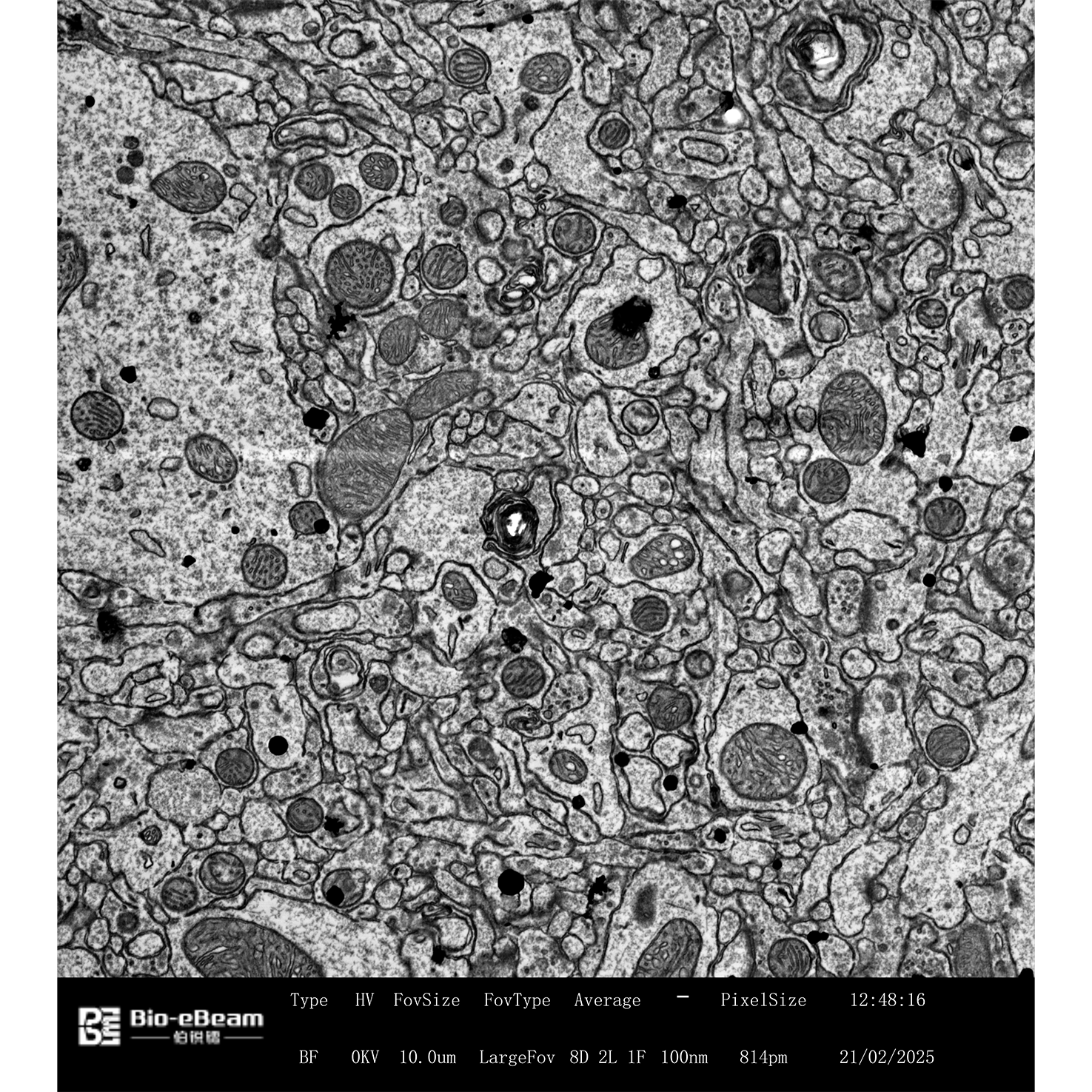 7-鼠脑切片-2