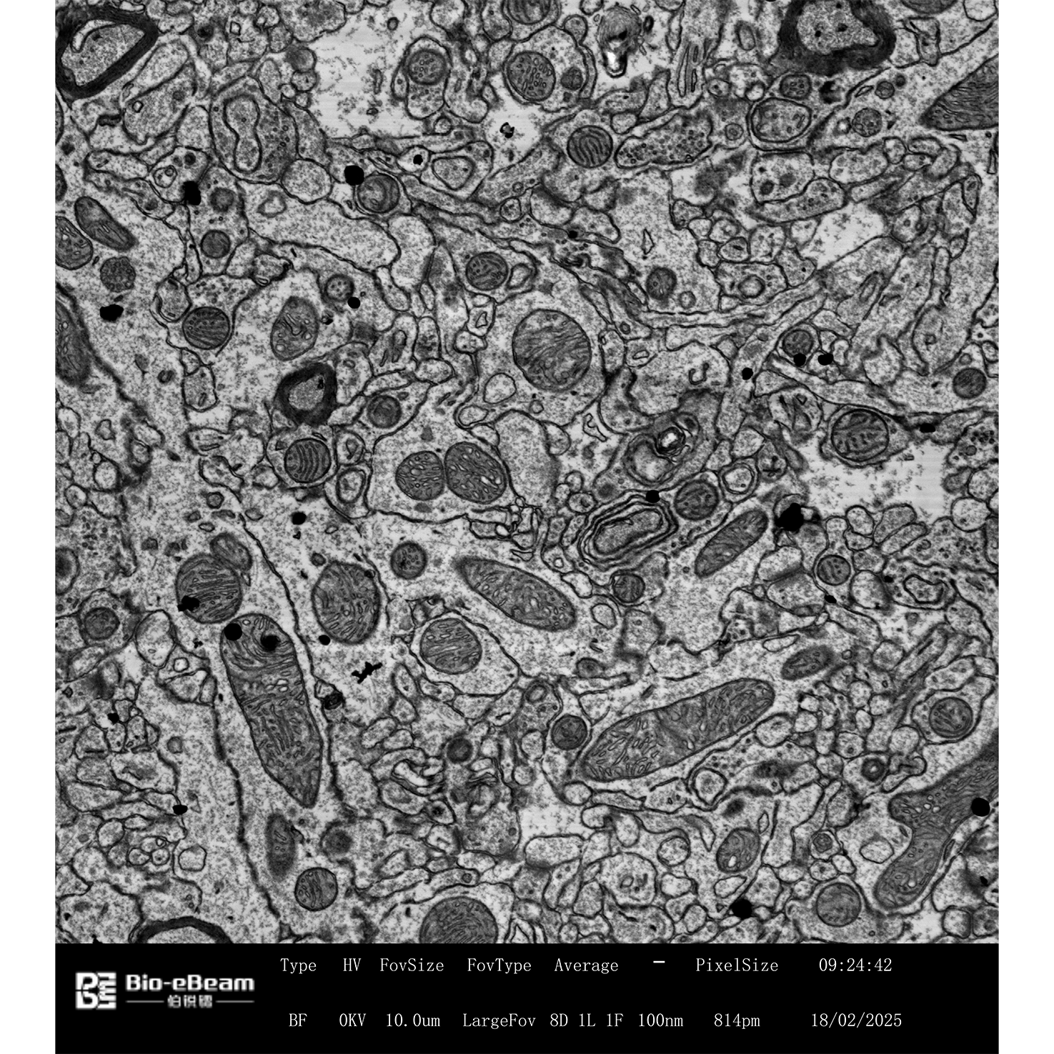 12-鼠脑切片-7