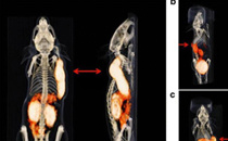 肿瘤PET成像新试剂研究