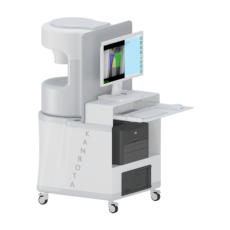 DEXA-iMAX 數(shù)字化雙能X射線骨密度