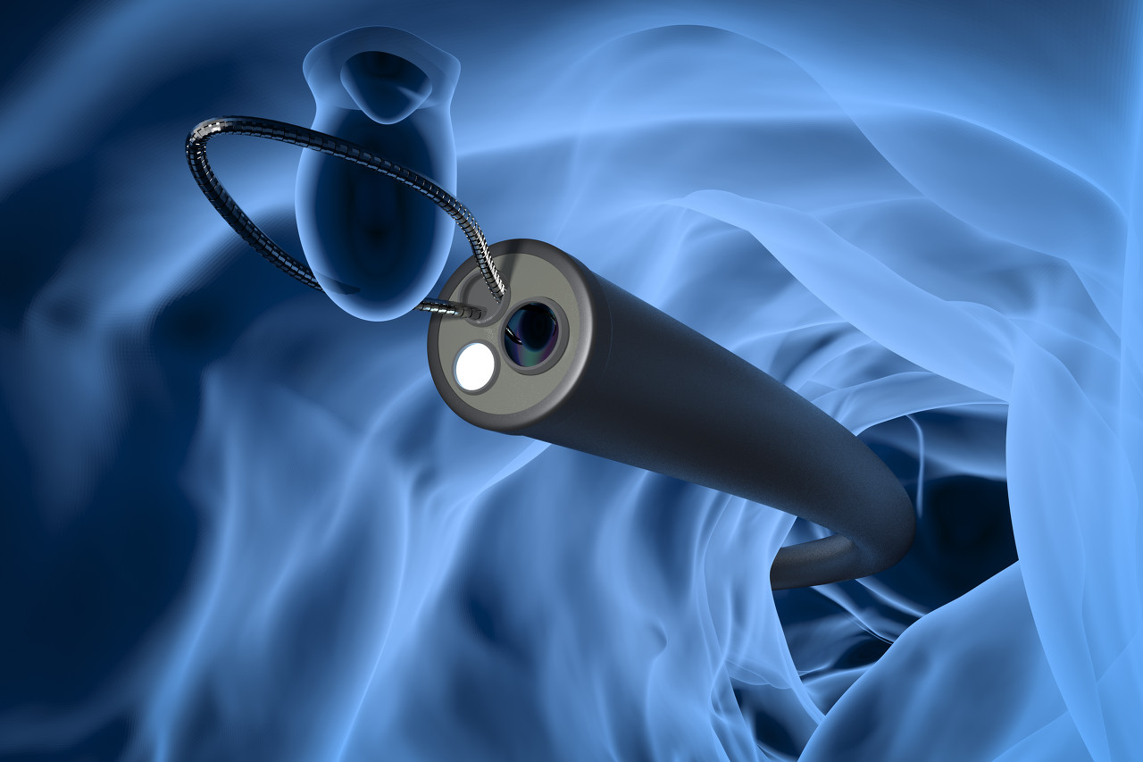 Medical Innovation Technology: New Application and Breakthrough of Urethral Cystoscope