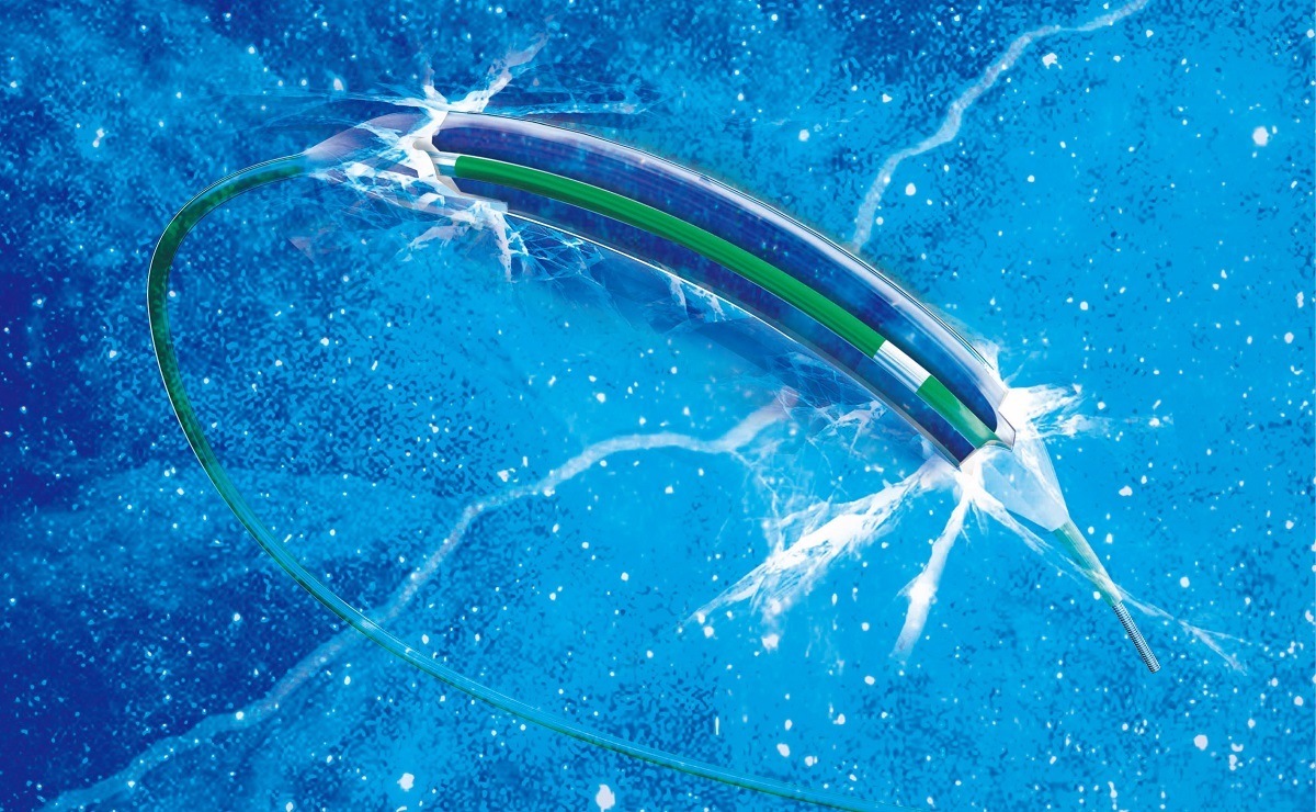 BrosMed Enters USA Coronary Angioplasty Catheter Market