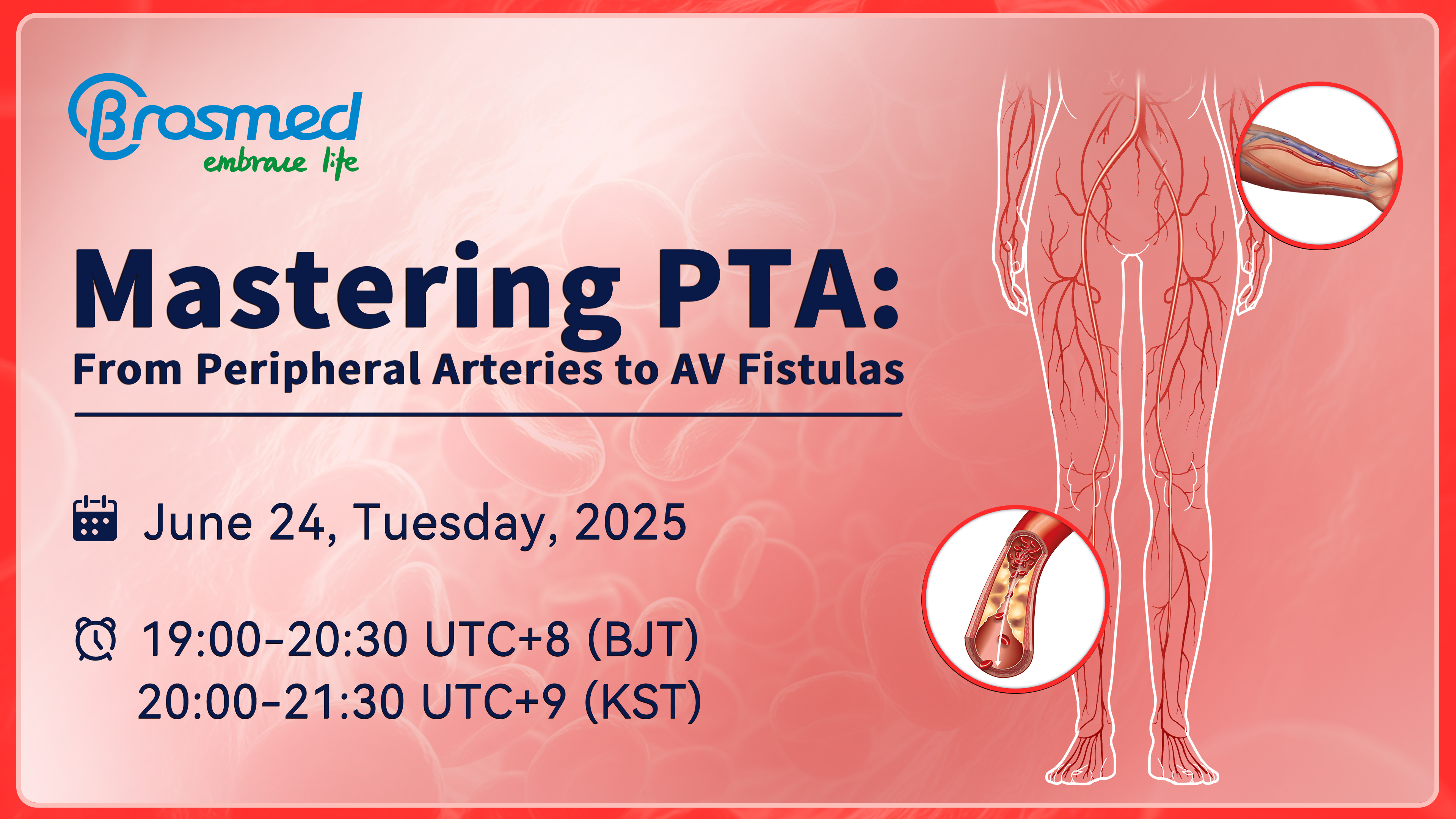 Webinar Invitation | Mastering PTA: From Peripheral Arteries to AV Fistulas
