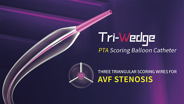 Case Interpretation | Outstanding Performance of Tri-Wedge™ in the 12atm Dilation of Severe Subclavian Vein Stenosis