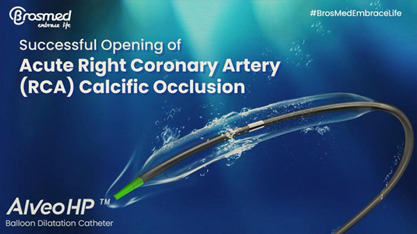 Case Interpretation | Successful Opening of Acute Right Coronary Artery (RCA) Occlusion with Calcification Using Alveo HP Φ0.75 mm Balloon