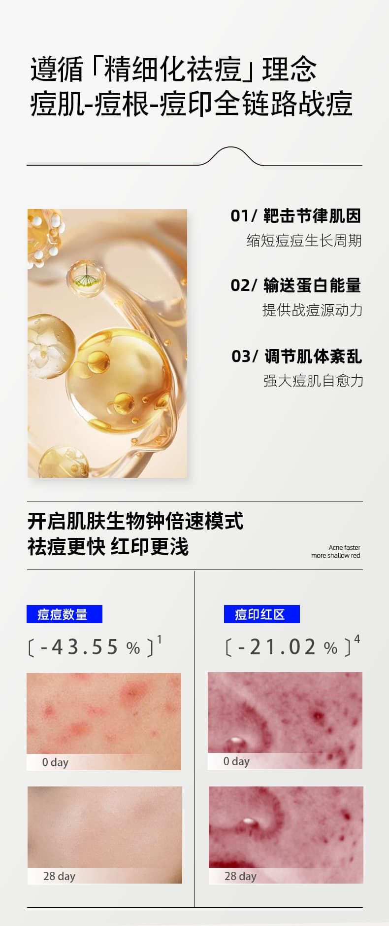 祛痘产品