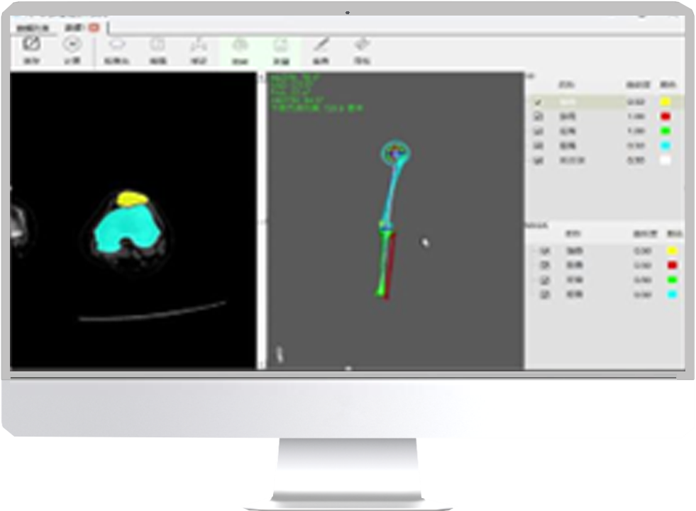 Long Bone Analysis and Design