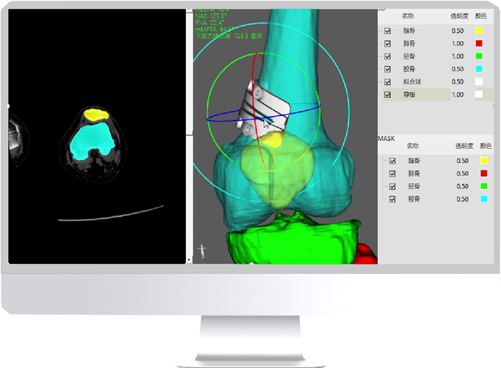 Long Bone Analysis and Design