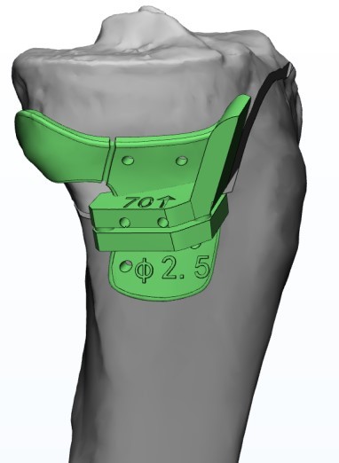 HTO Guide Plate