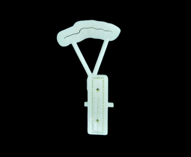 Diabetic foot bone Transverse bone handling Osteotomy guide plate