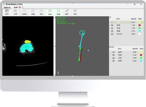 Medical Image AI Reconstruction