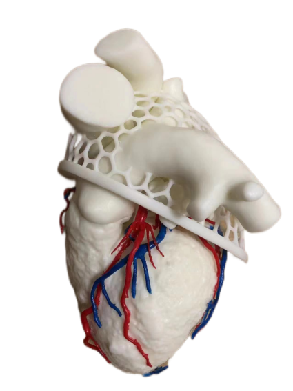 Cardiac surgery Coronary artery three-dimensional reconstruction