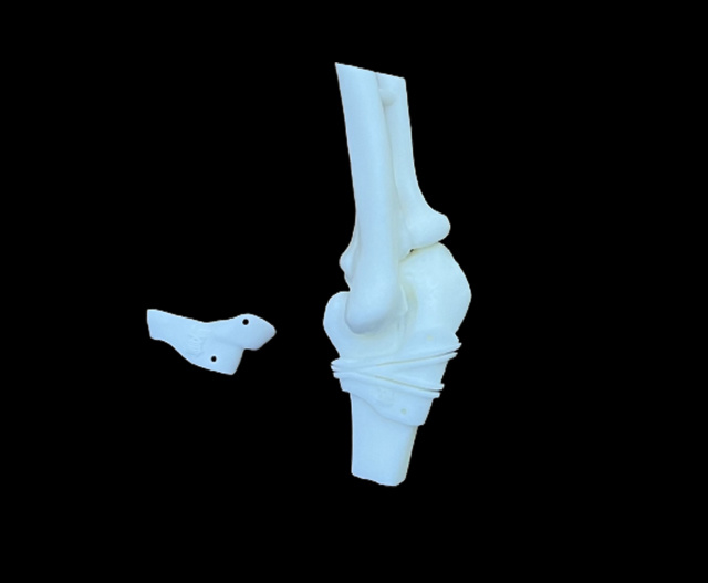 Arthrodesis osteotomy guide plate