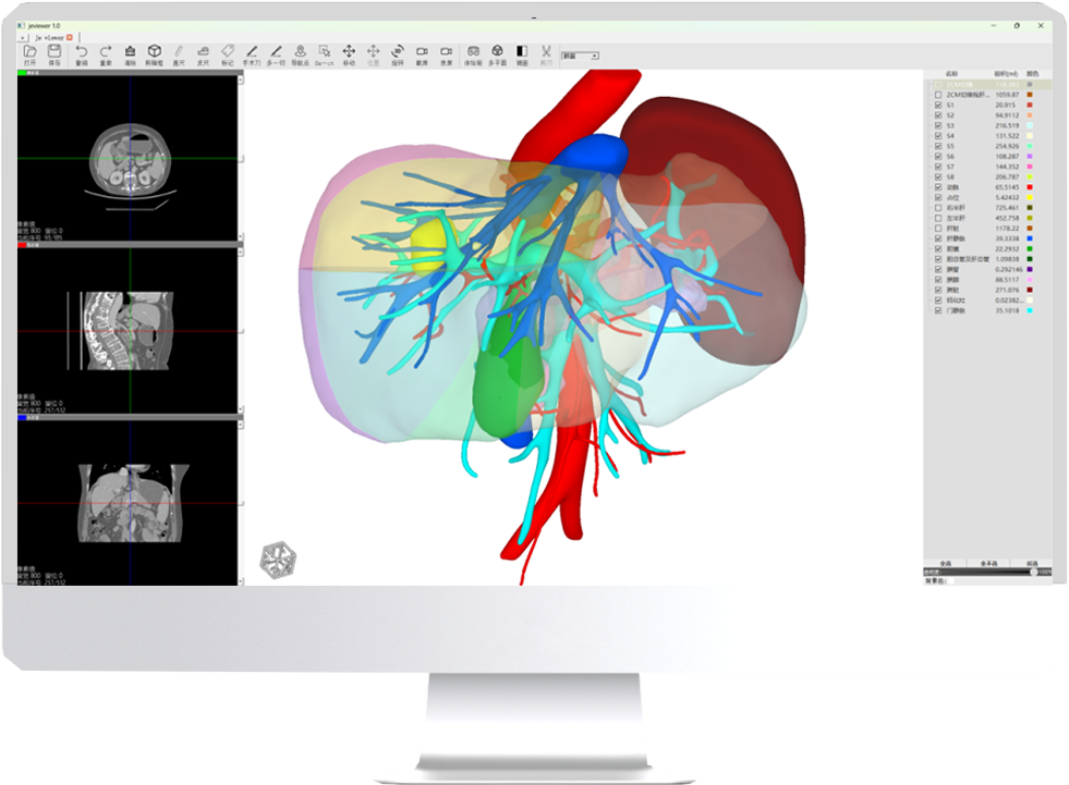 3D surgical planning software