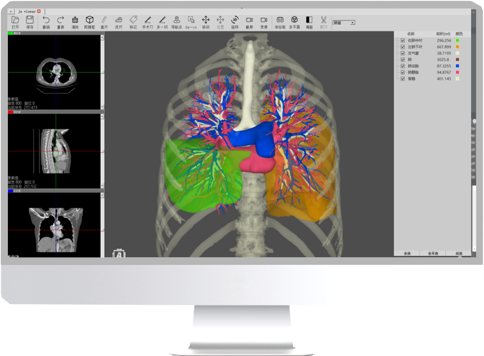 3D surgical planning software