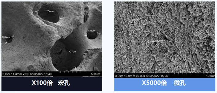普思泰?骨修復材料 普思泰?骨修復材料