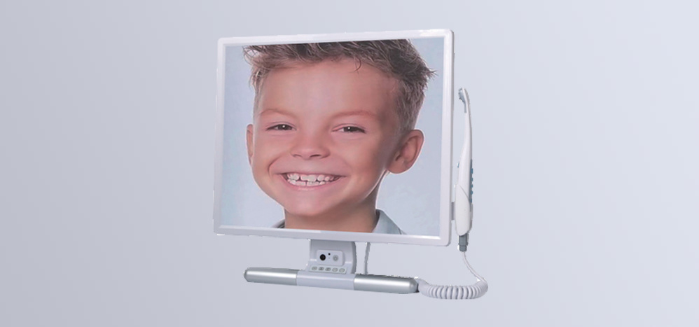 Endoscope