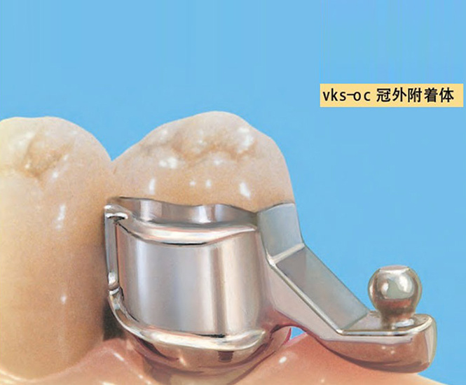 精密附件