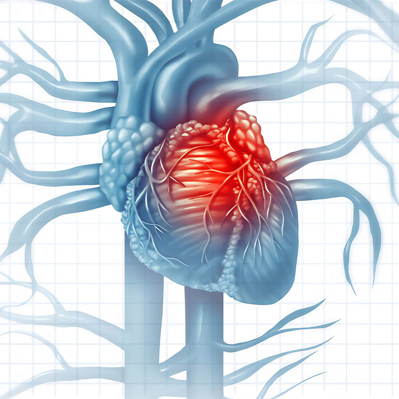 Cardiovascular  and  Cerebrovascular Health