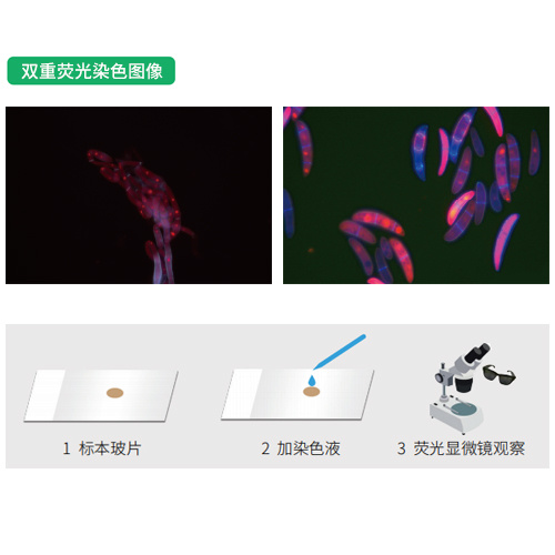 真菌雙重?zé)晒馊旧? title=