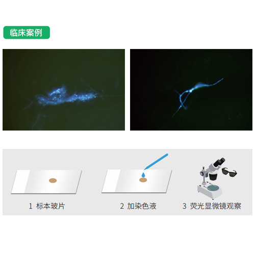 真菌檢測(cè)熒光染料