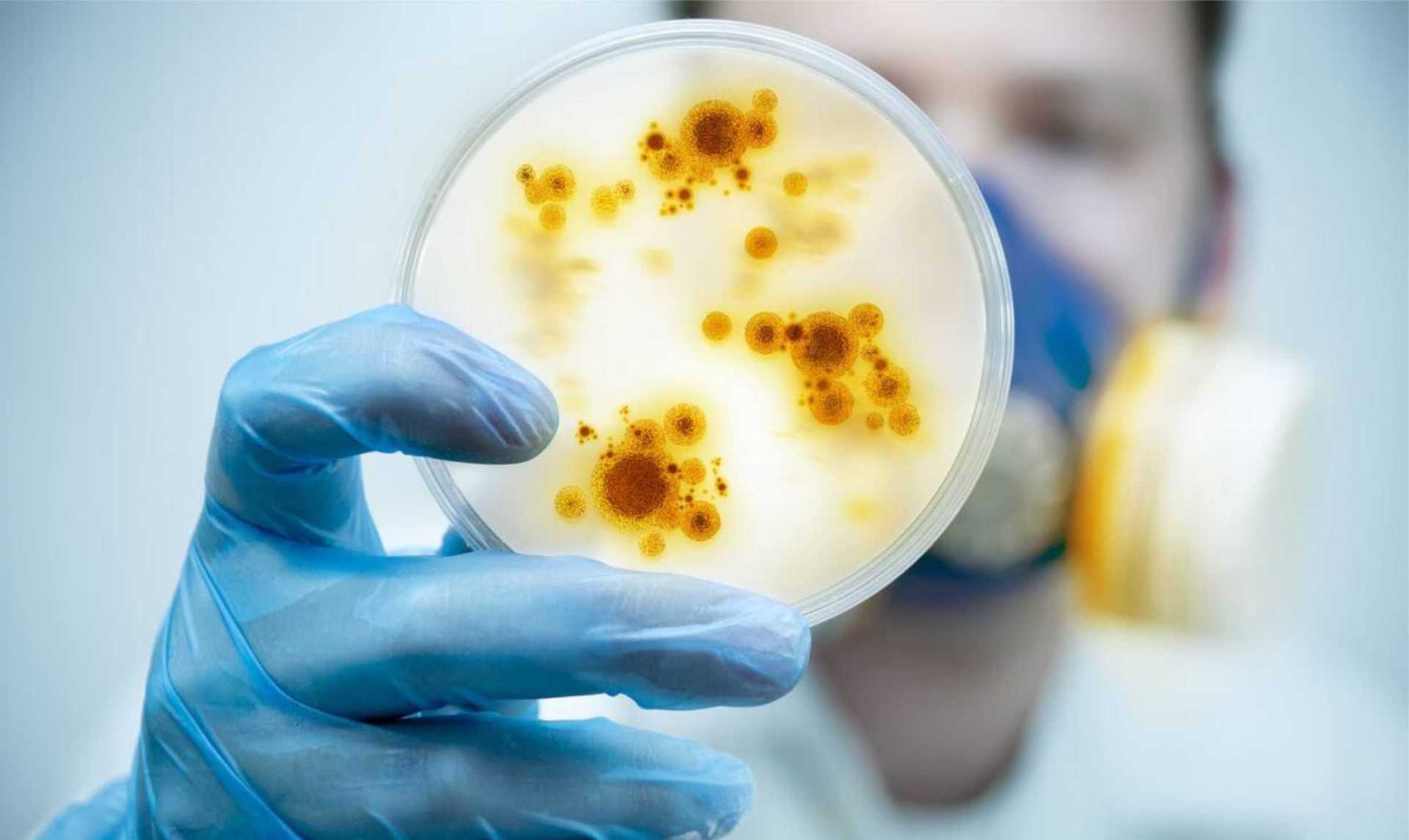 Quality Control Measures of Medium in Microbiological Testing