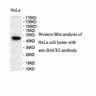 BACE2 antibody (pAb) BACE2 antibody (pAb)