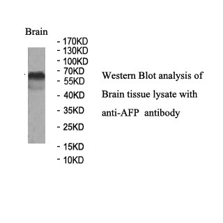 AFP antibody (mAb) AFP antibody (mAb)