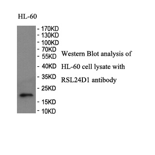 RSL24D1 antibody (pAb) RSL24D1 antibody (pAb)