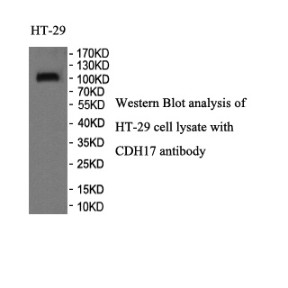 CDH17 antibody (mAb) CDH17 antibody (mAb)
