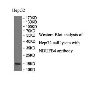 NDUFB4 antibody (pAb) NDUFB4 antibody (pAb)