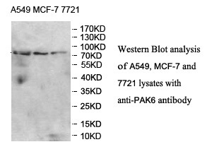PAK6 antibody (pAb) PAK6 antibody (pAb)
