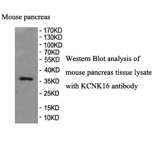KCNK16 antibody (pAb) KCNK16 antibody (pAb)