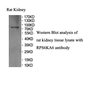 RPS6KA6 antibody (pAb)