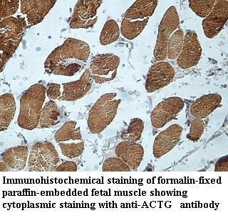 ACTG antibody (pAb)