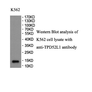 TPD52L1 antibody (pAb) TPD52L1 antibody (pAb)