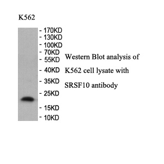 SRSF10 antibody (pAb) SRSF10 antibody (pAb)