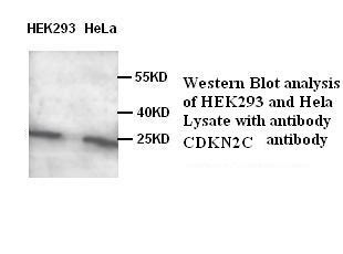 CDKN2C antibody (pAb)
