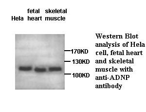 ADNP antibody (pAb)