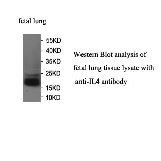 IL4 antibody (mAb) IL4 antibody (mAb)