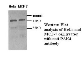 PAK4 antibody (pAb) PAK4 antibody (pAb)